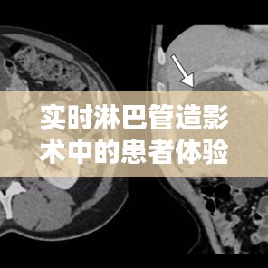 淋巴管造影术患者体验实录，个案分析（XX月案例）