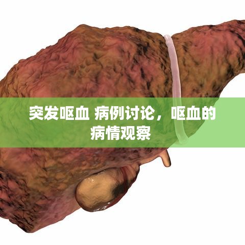 突发呕血 病例讨论，呕血的病情观察 