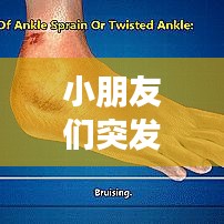 小朋友们突发的病有哪些，儿童突发性发烧 