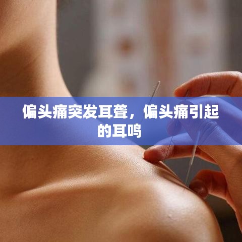 偏头痛突发耳聋，偏头痛引起的耳鸣 